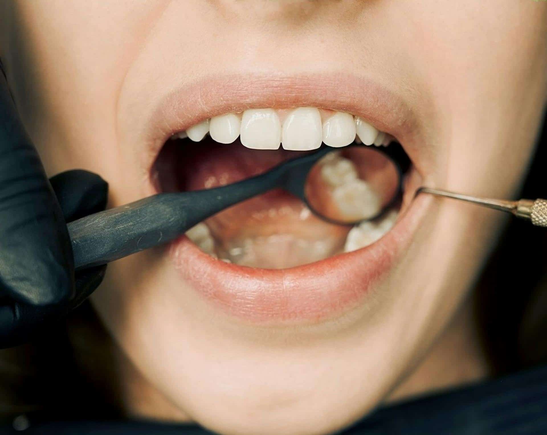 Debunking Common Myths About Oral Health